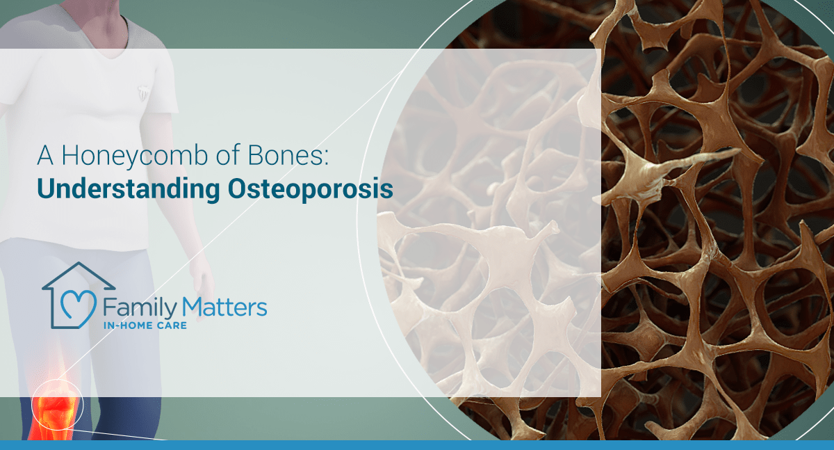 A Honeycomb Of Bones: Understanding Osteoporosis