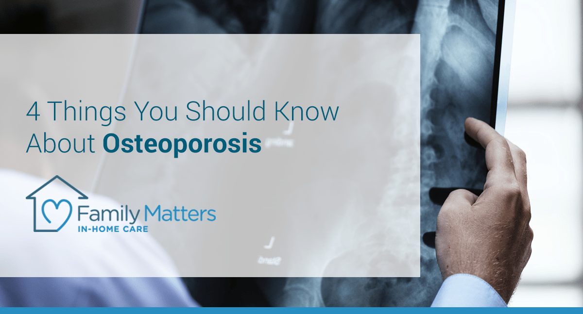 4 Things You Should Know About Osteoporosis